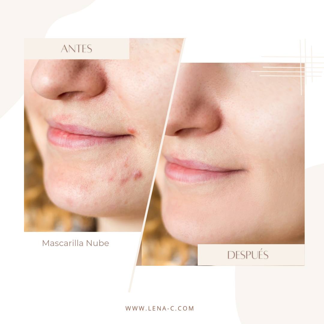 Mascarilla Nube